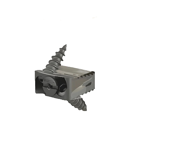 Anterior Cervical Detail